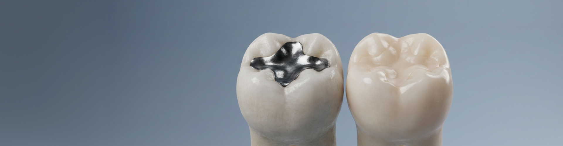 Comparison of a molar with a silver amalgam filling and a natural-looking tooth-colored restoration at Long Beach Family Dentist.
